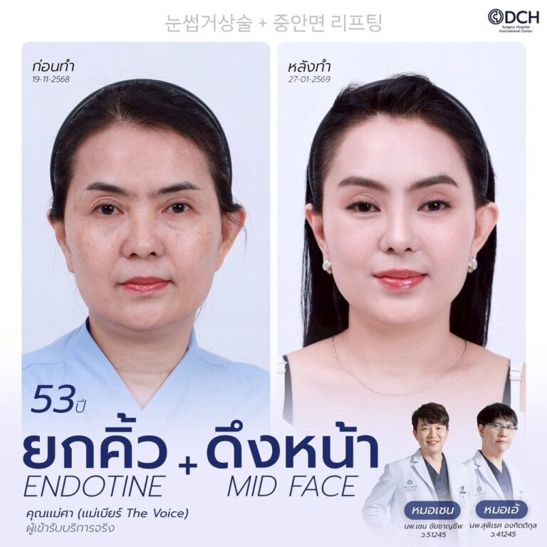 ยกคิ้ว EBL