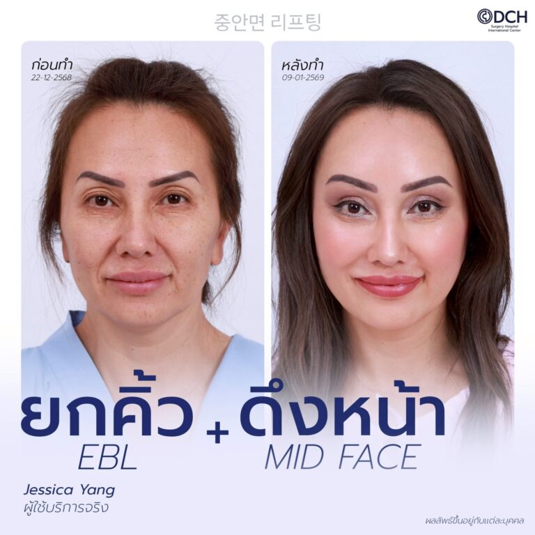ยกคิ้ว EBL