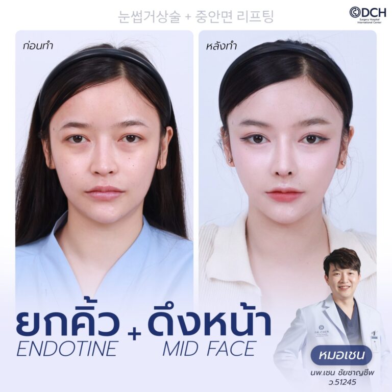 ยกคิ้ว EBL