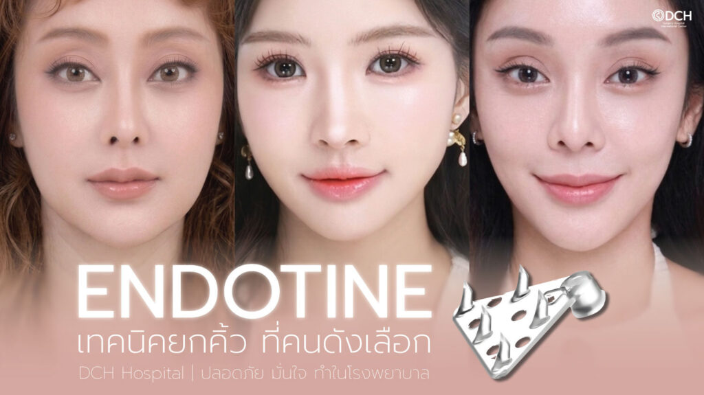 ส่องกล้องยกคิ้ว Endotine เทคนิคยกคิ้วที่คนดังเลือกทำ