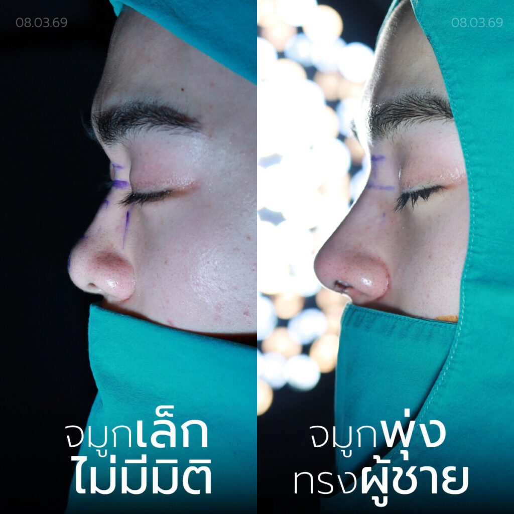 เสริมครั้งแรก