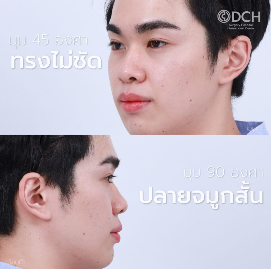 เสริมครั้งแรก