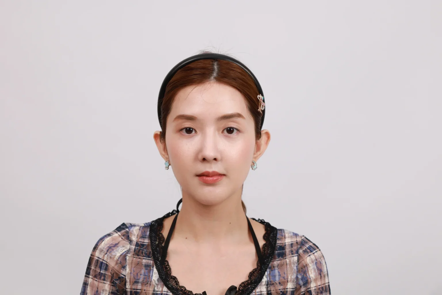 รีวิวเสริมจมูก คุณเบียร์ The Voice-5