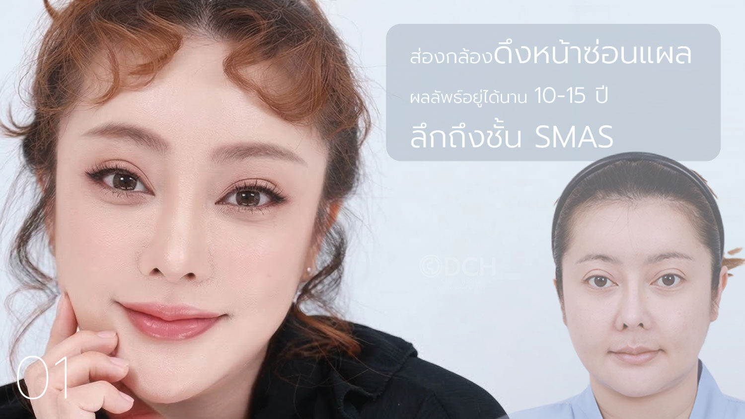 ดึงหน้าตึงx3