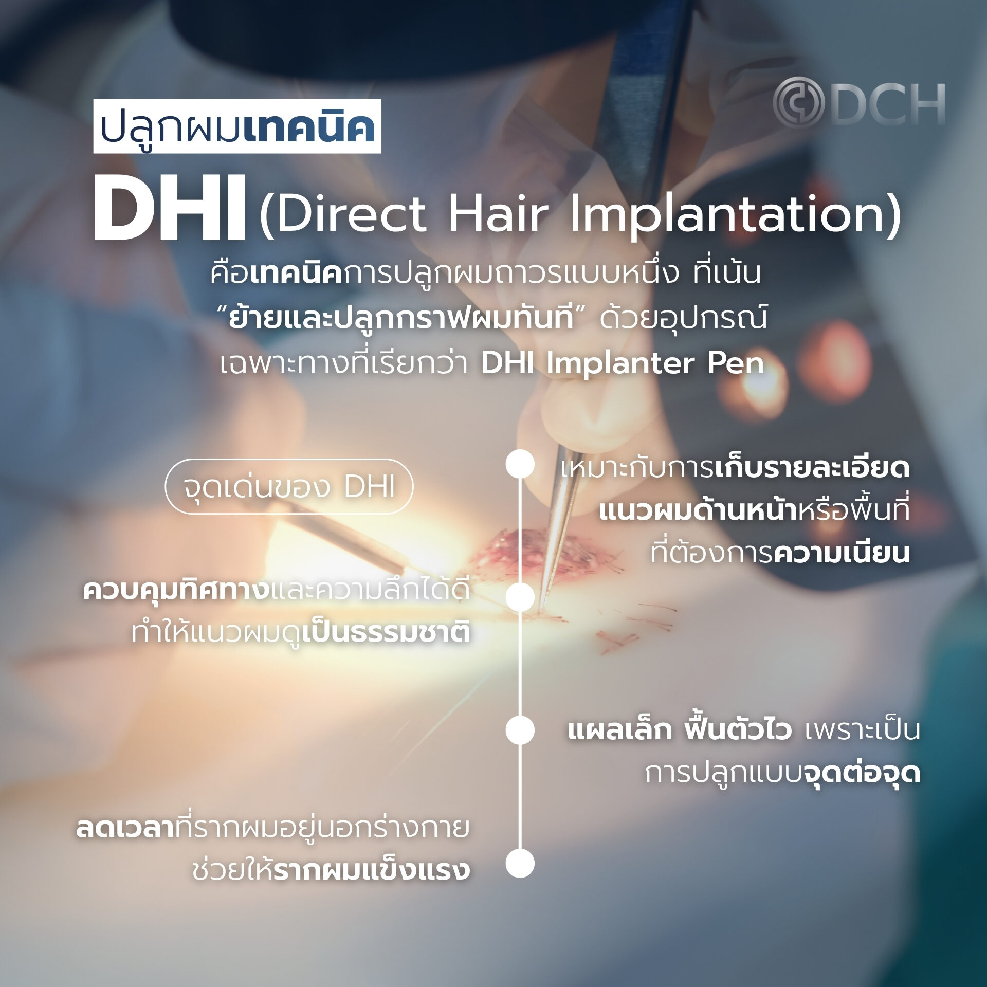 ปลูกผม หมอแบงค์ ด้วยเทคนิค DHI ความละเอียดสูง ที่ DCH