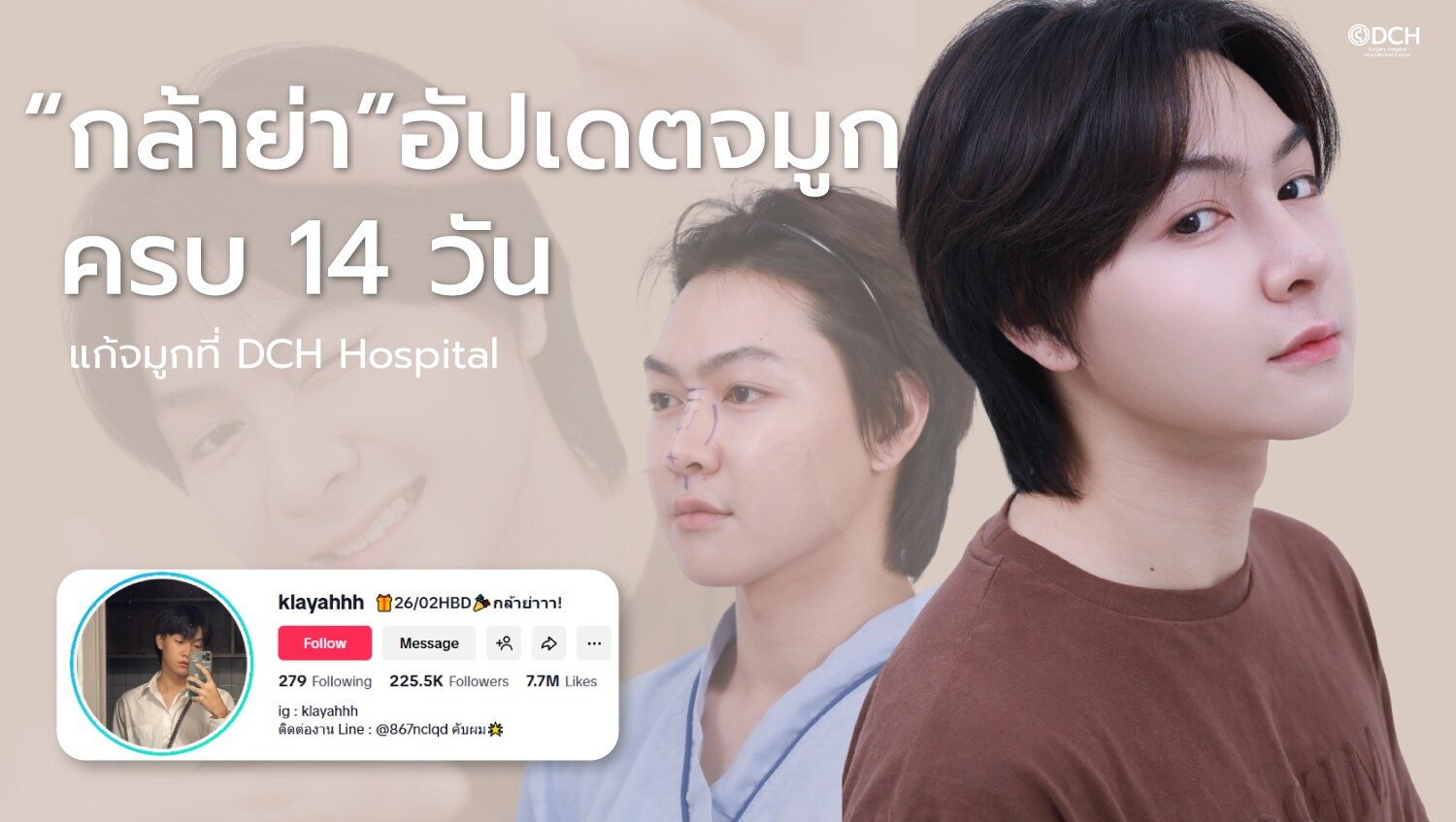 แก้จมูก