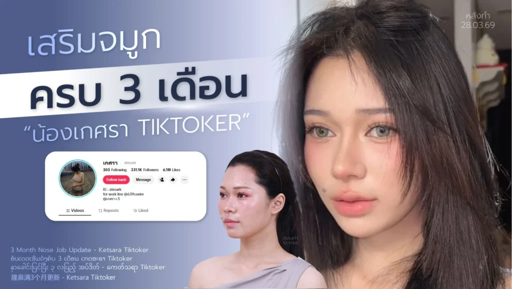 เสริมจมูกเกศรา