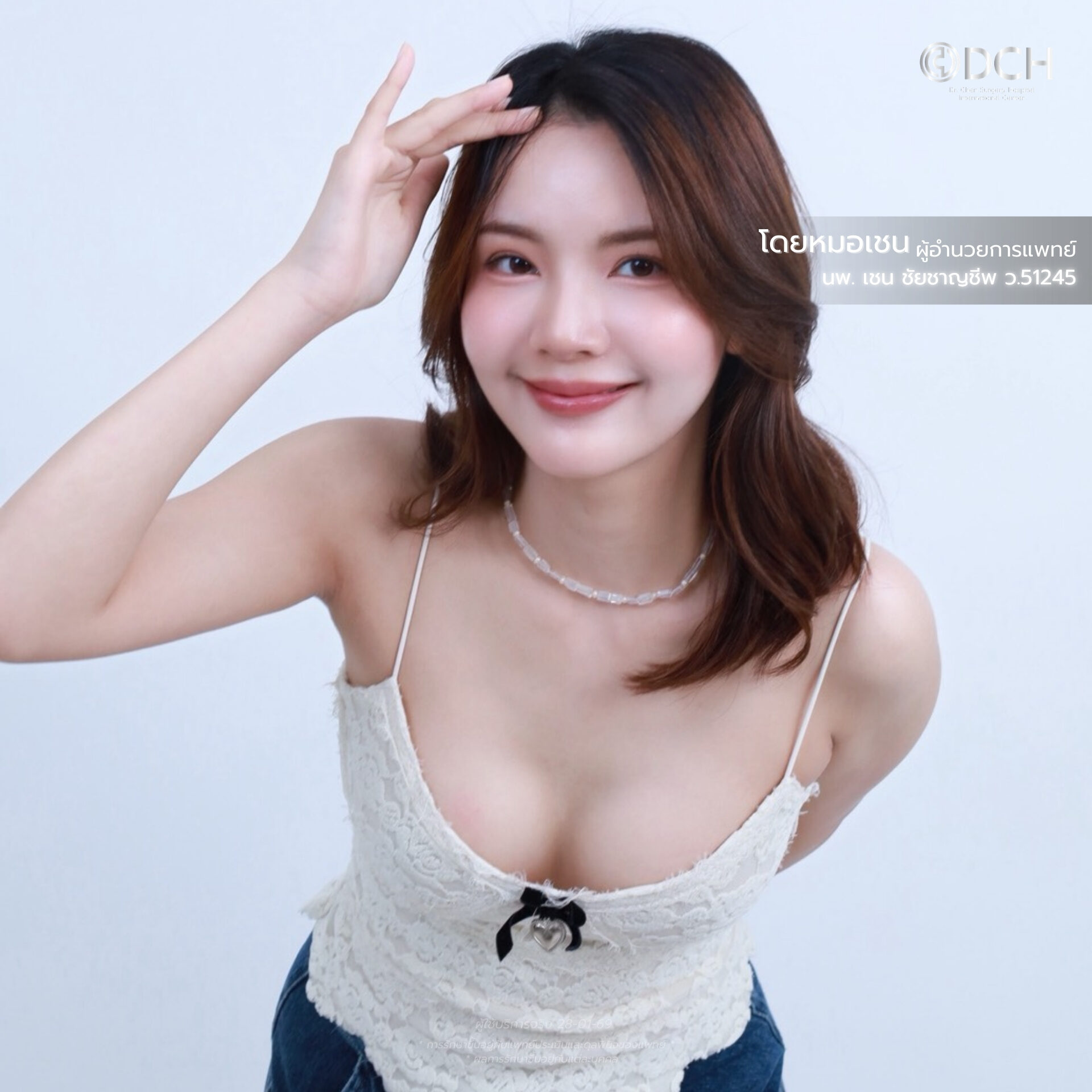 เสริมหน้าอก Mentor 4DX หมอเชน รีวิวทรงอกธรรมชาติ DCH Korea 4DX