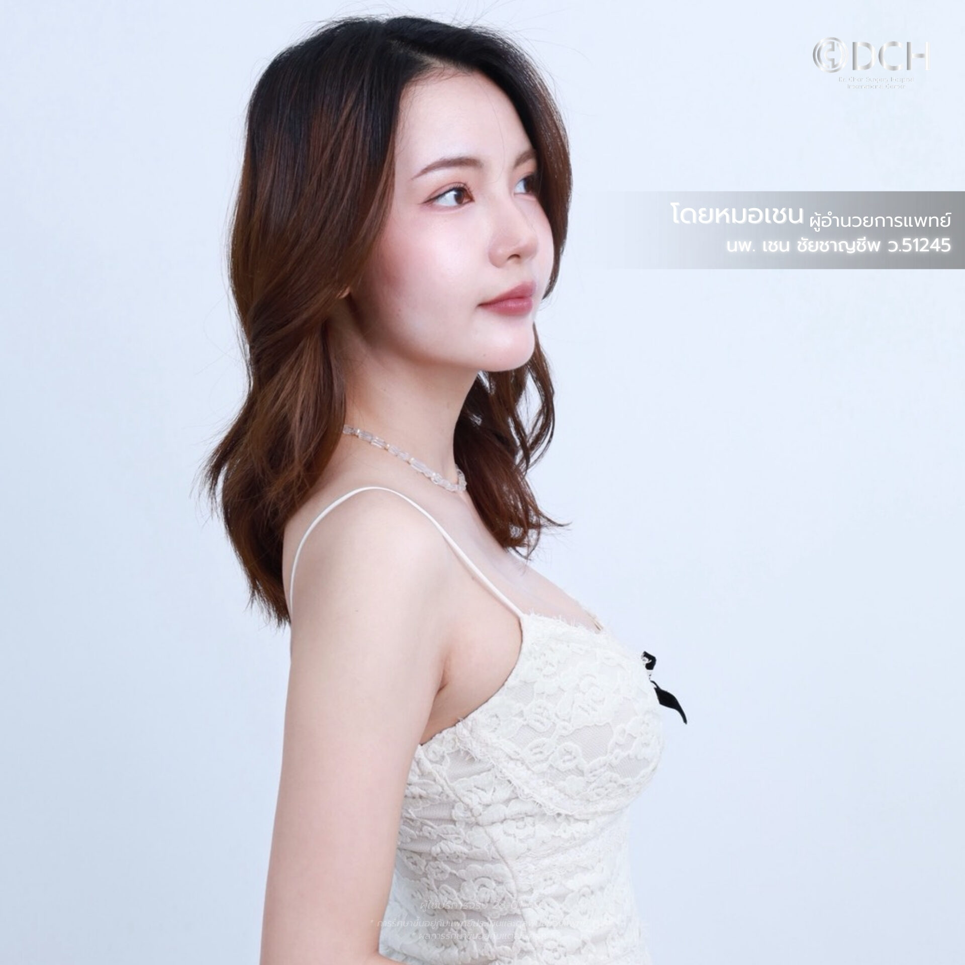 เสริมหน้าอก Mentor 4DX หมอเชน รีวิวทรงอกธรรมชาติ DCH Korea 4DX