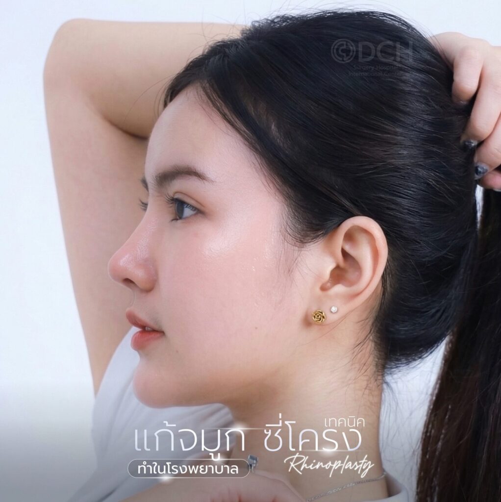 แก้จมูกคุณปอ