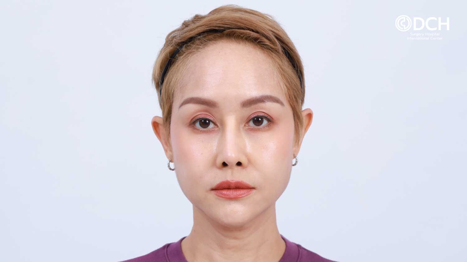 ดึงหน้า