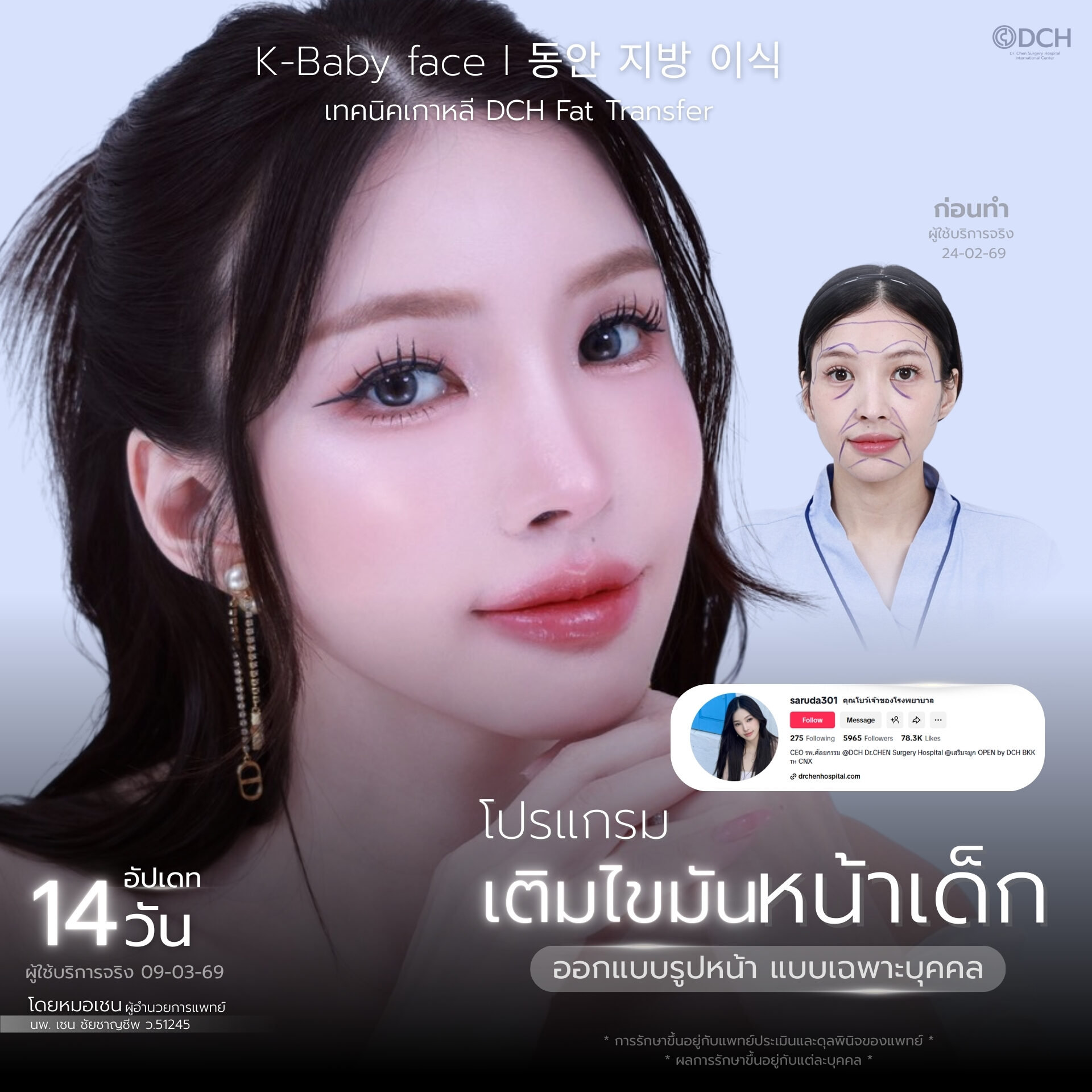 เติมไขมันหน้าเด็ก ขั้นตอนประเมินและออกแบบรูปหน้าโดยแพทย์