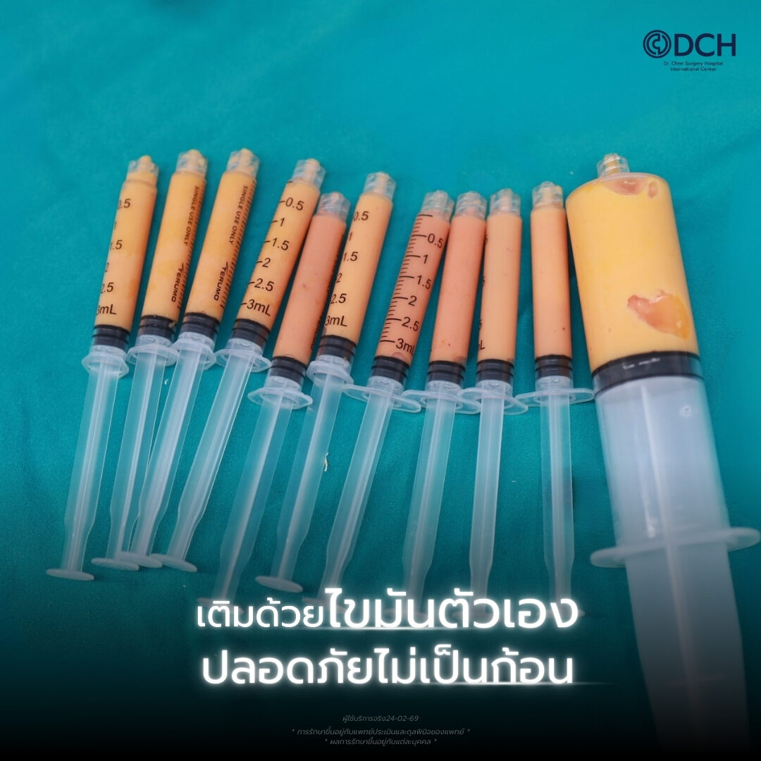 เติมไขมันหน้าเด็ก ขั้นตอนประเมินและออกแบบรูปหน้าโดยแพทย์