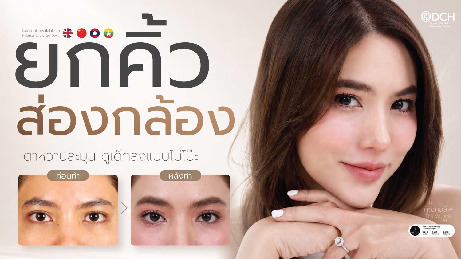 ส่องกล้องยกคิ้ว