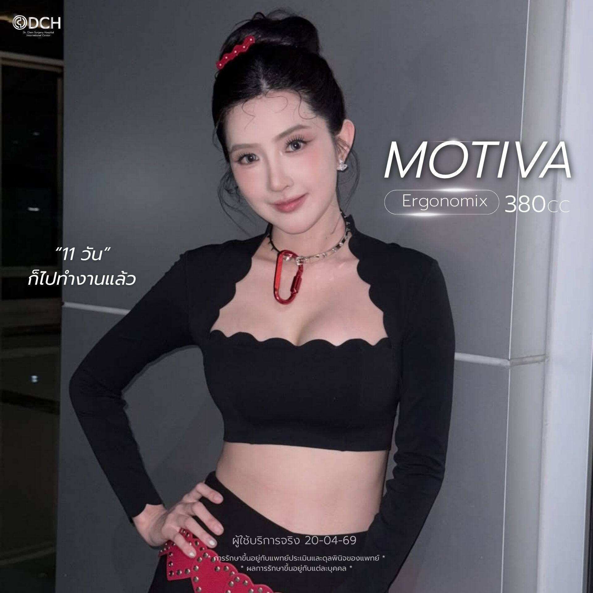 เบียร์ The Voice รีวิวเสริมหน้าอก 11 วัน ด้วย Motiva Ergonomix 380cc ที่ DCH Hospital