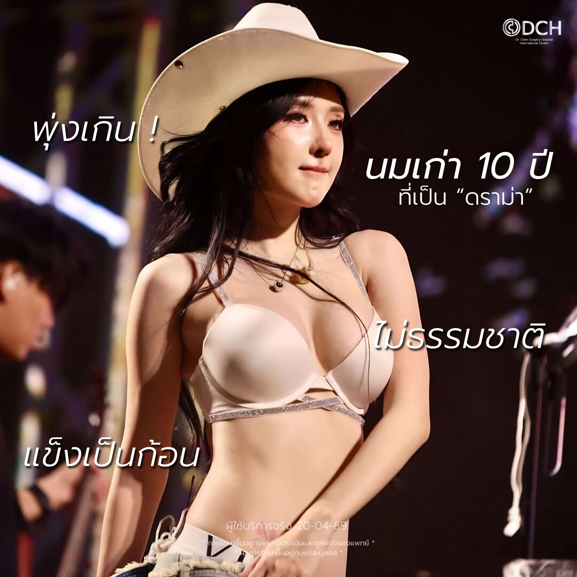 เบียร์ The Voice อัปเดทหน้าอก 14 วัน ทรงสวยธรรมชาติ นุ่มเด้ง ที่ DCH Hospital