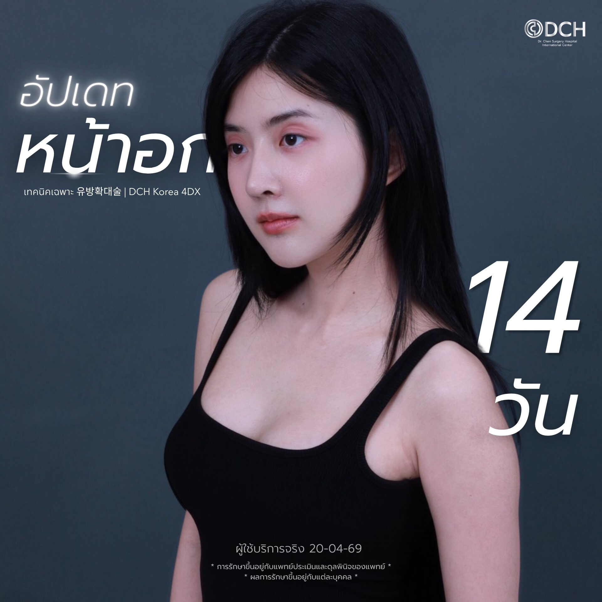 เบียร์ The Voice อัปเดทหน้าอก 14 วัน ทรงสวยธรรมชาติ นุ่มเด้ง ที่ DCH Hospital