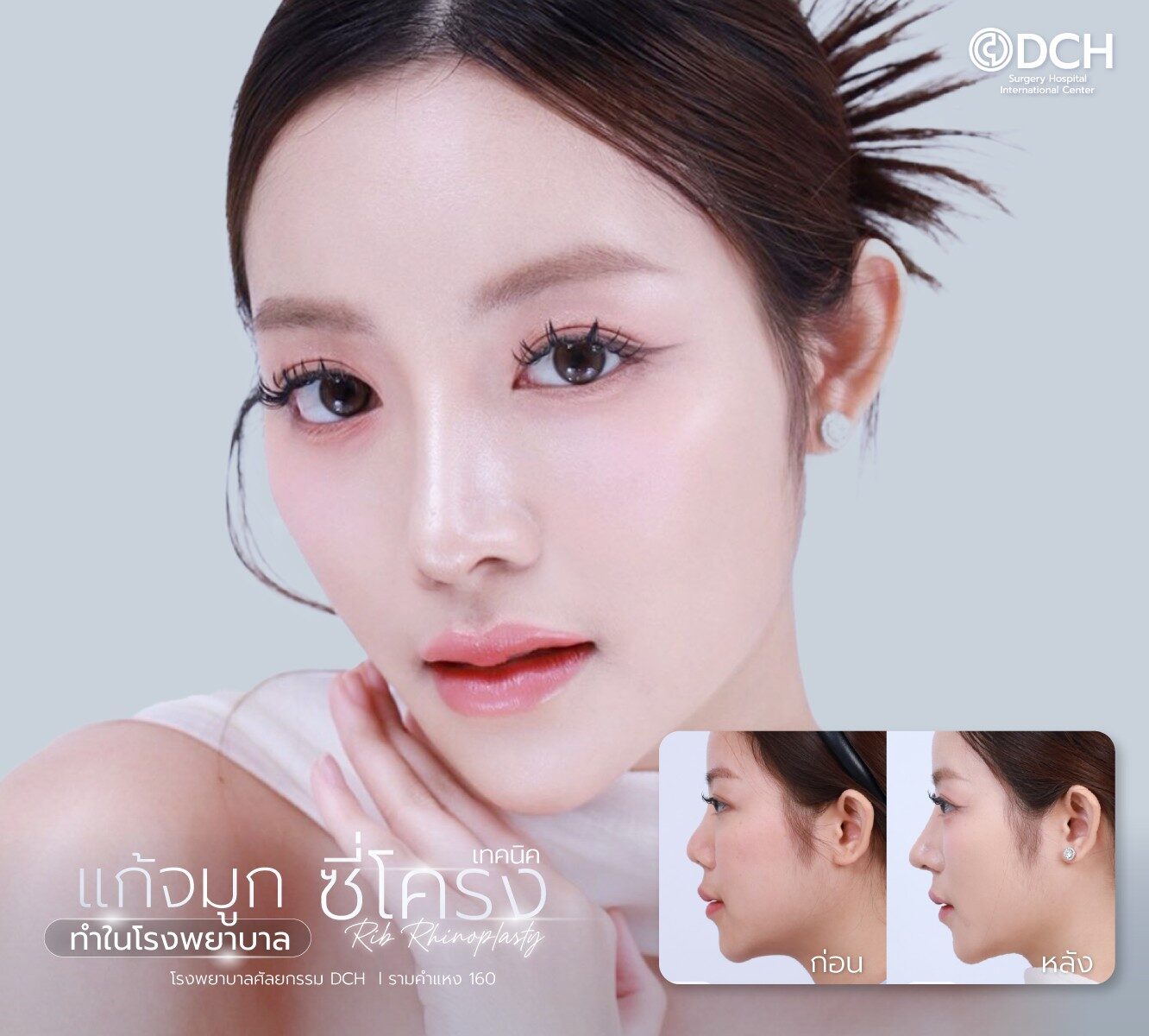 แก้จมูกซี่โครง