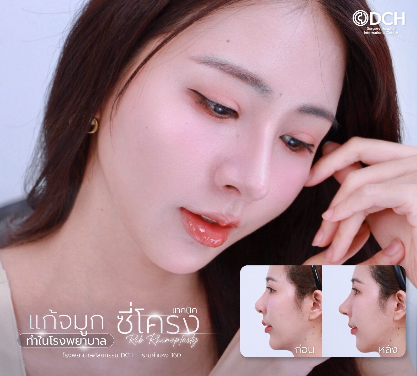แก้จมูกซี่โครง