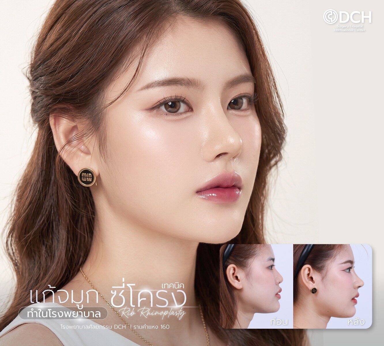 แก้จมูกซี่โครง
