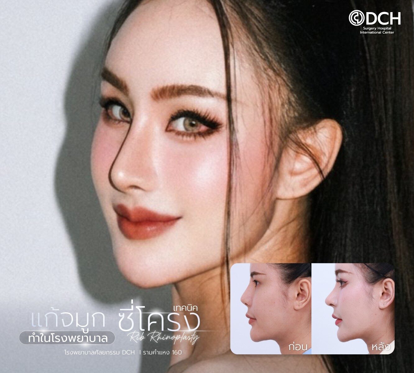 แก้จมูกซี่โครง