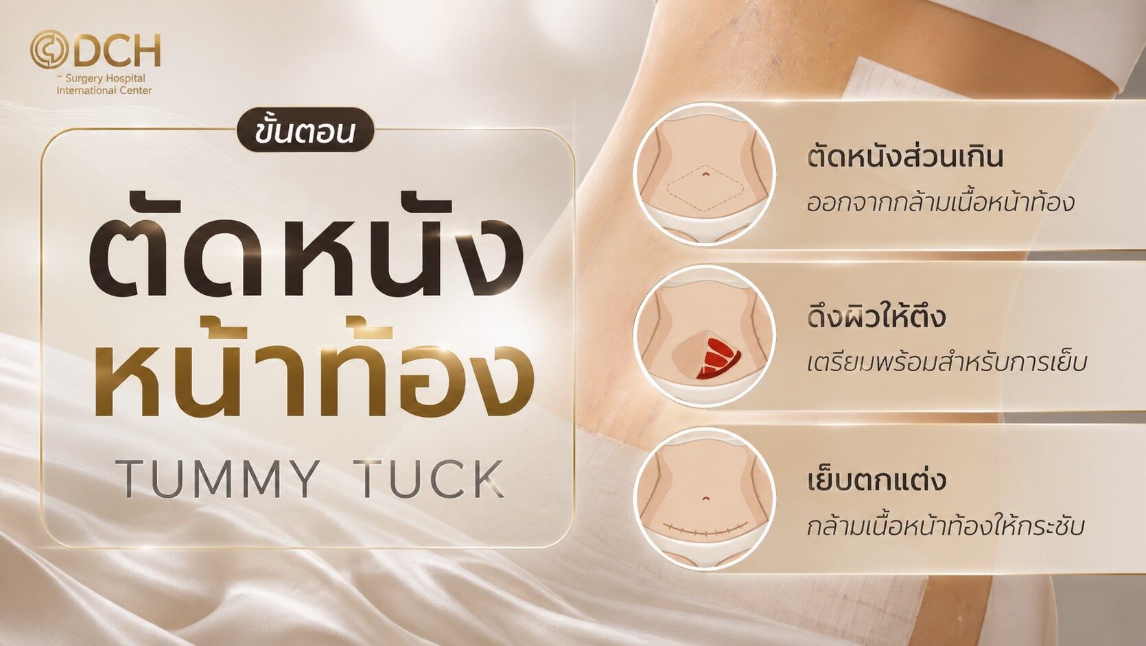 ตัดหนังหน้าท้อง