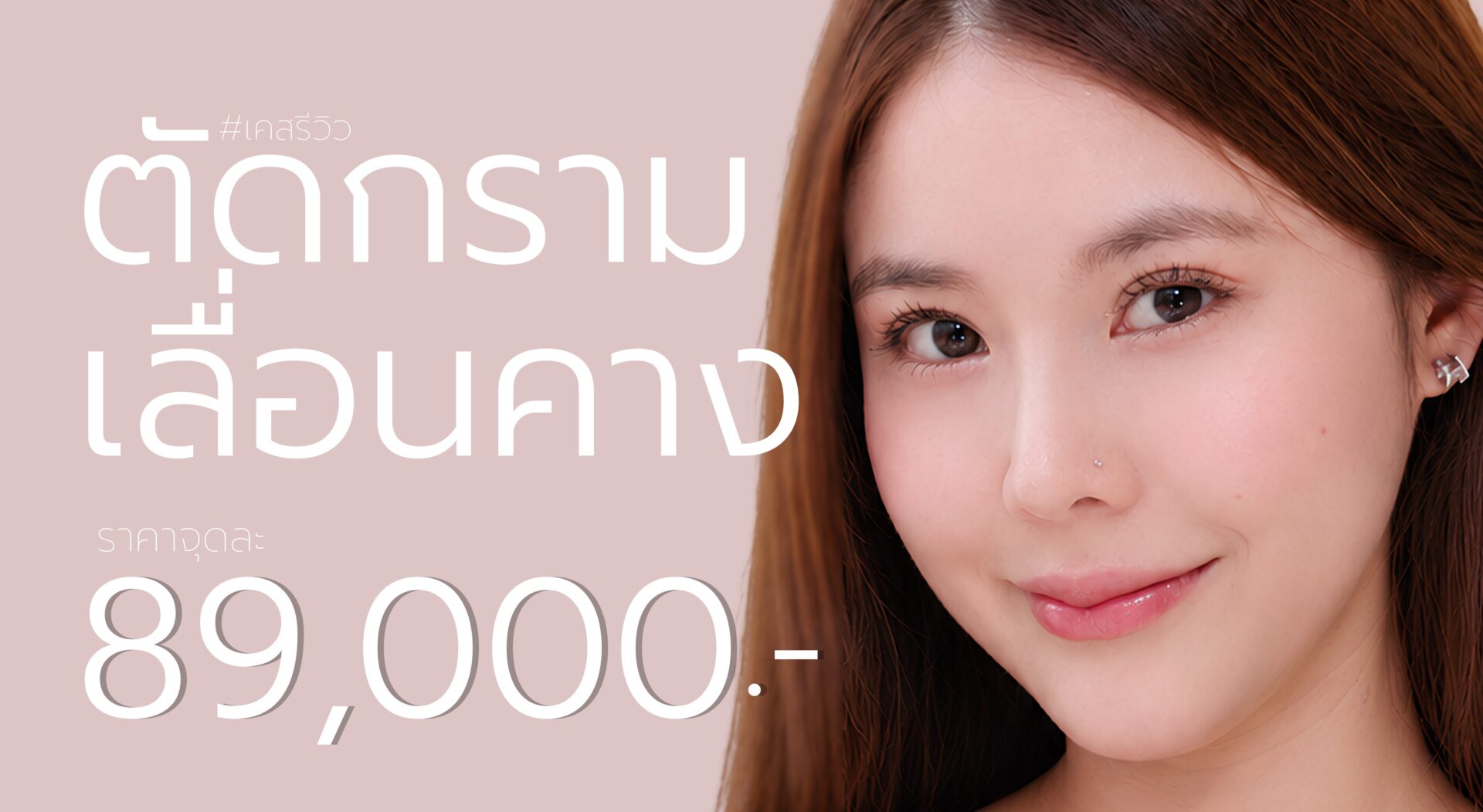 ตัดกราม เลื่อนคาง