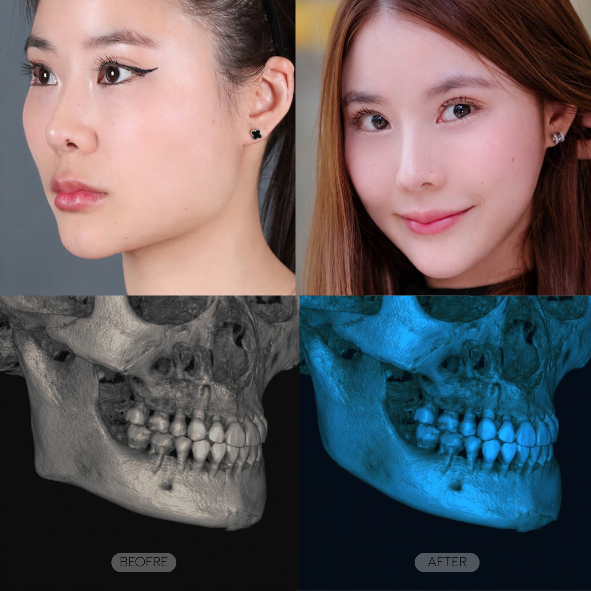 ตัดกราม