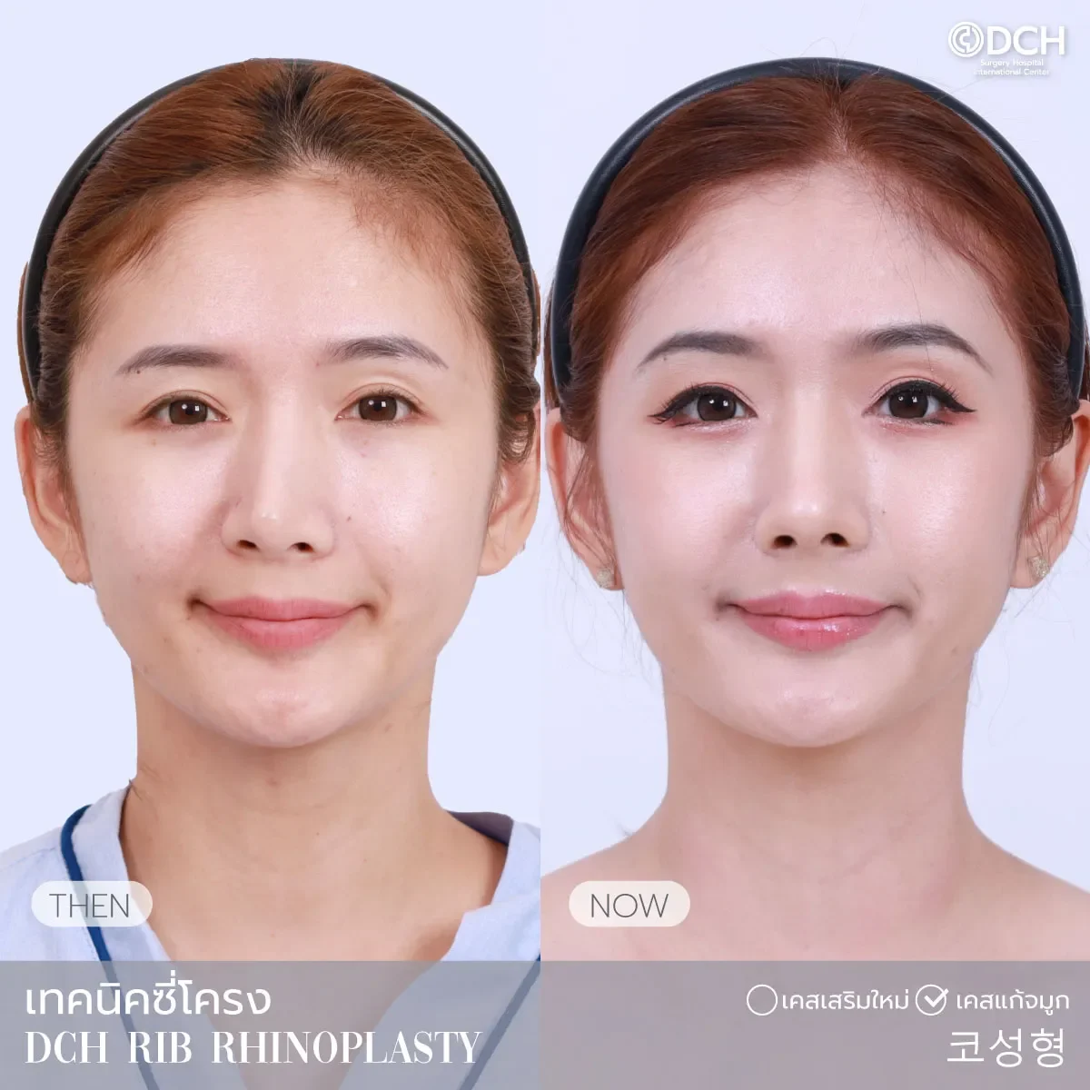 B-A- คุณโม 0_1