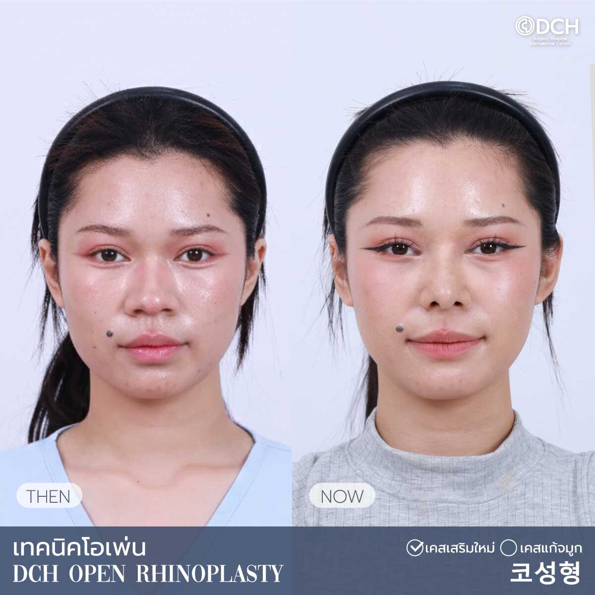 B-Aคุณเกศ1_0