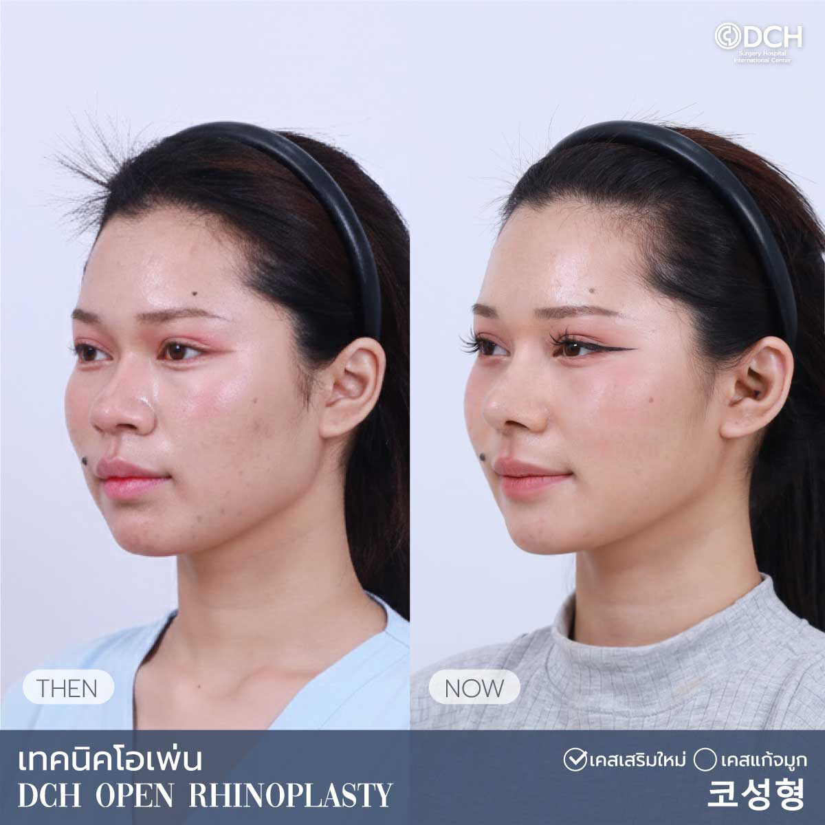 B-Aคุณเกศ2_0