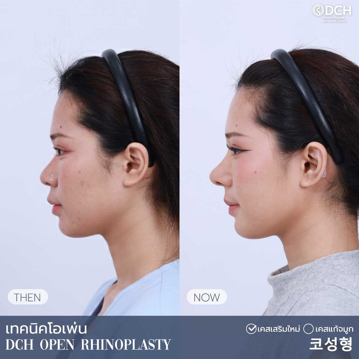 B-Aคุณเกศ3_0
