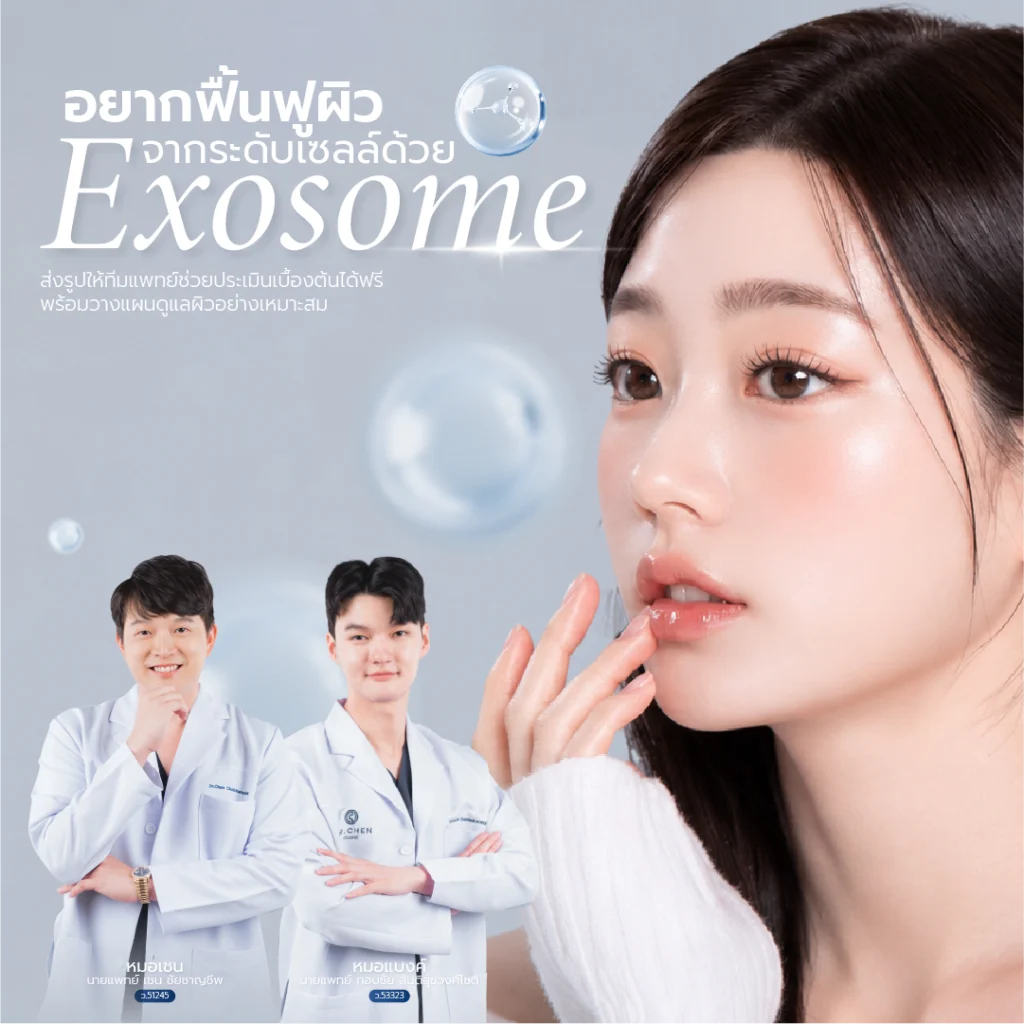 Exosome