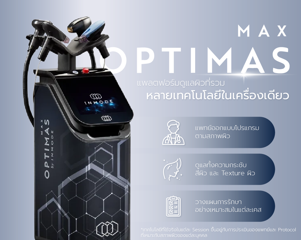 OPTIMAS Max