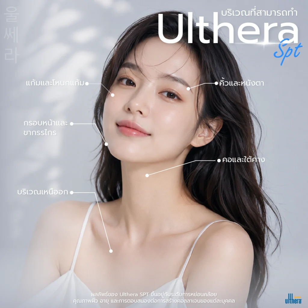 Ulthera