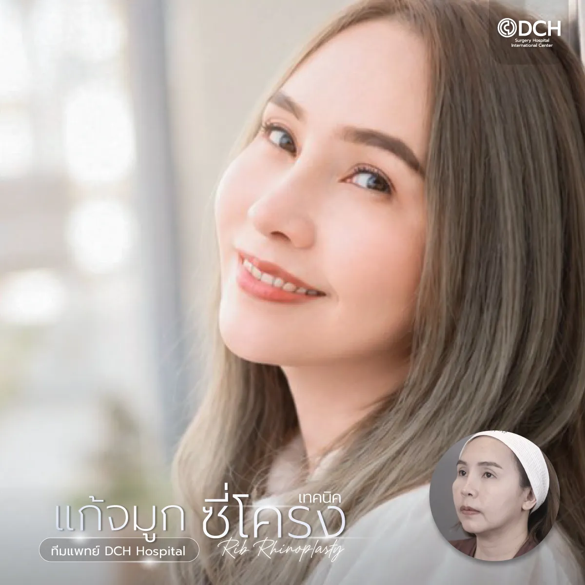 แก้