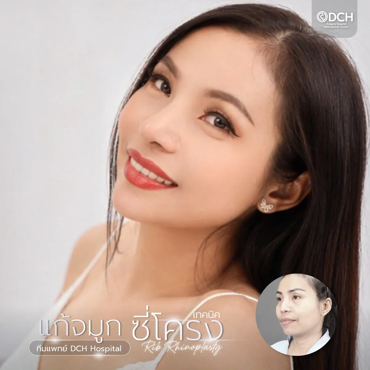 แก้จมูก