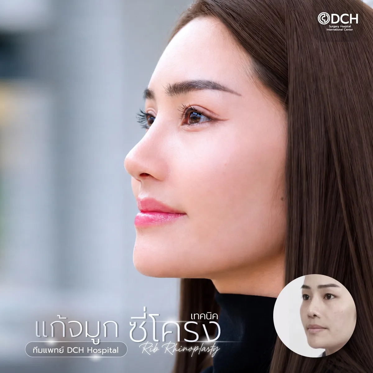 แก้