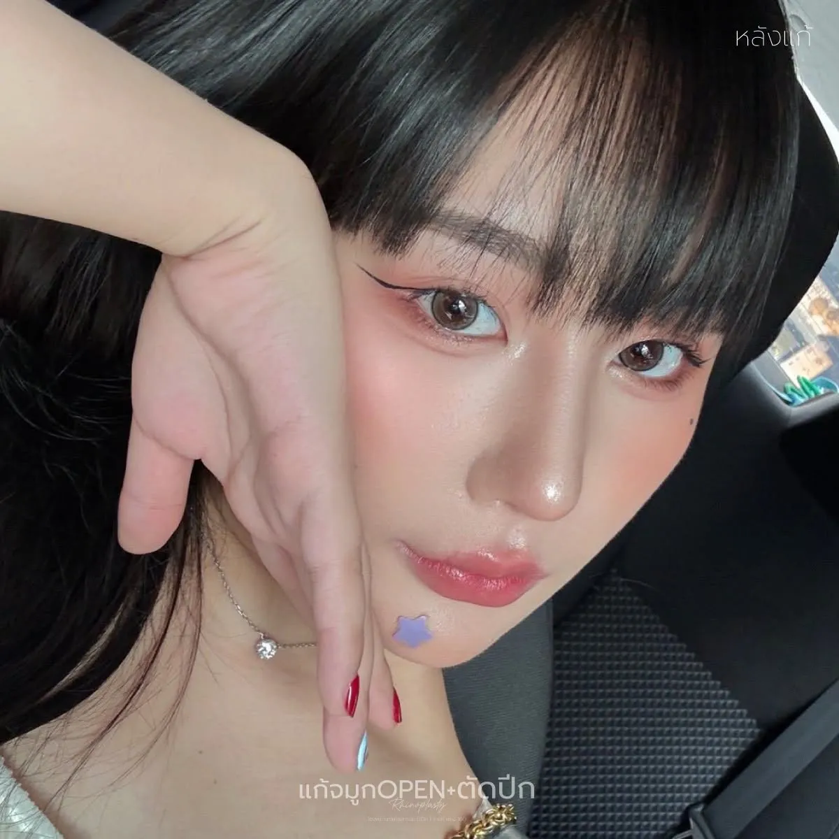 จมูกเกาหลี (4)