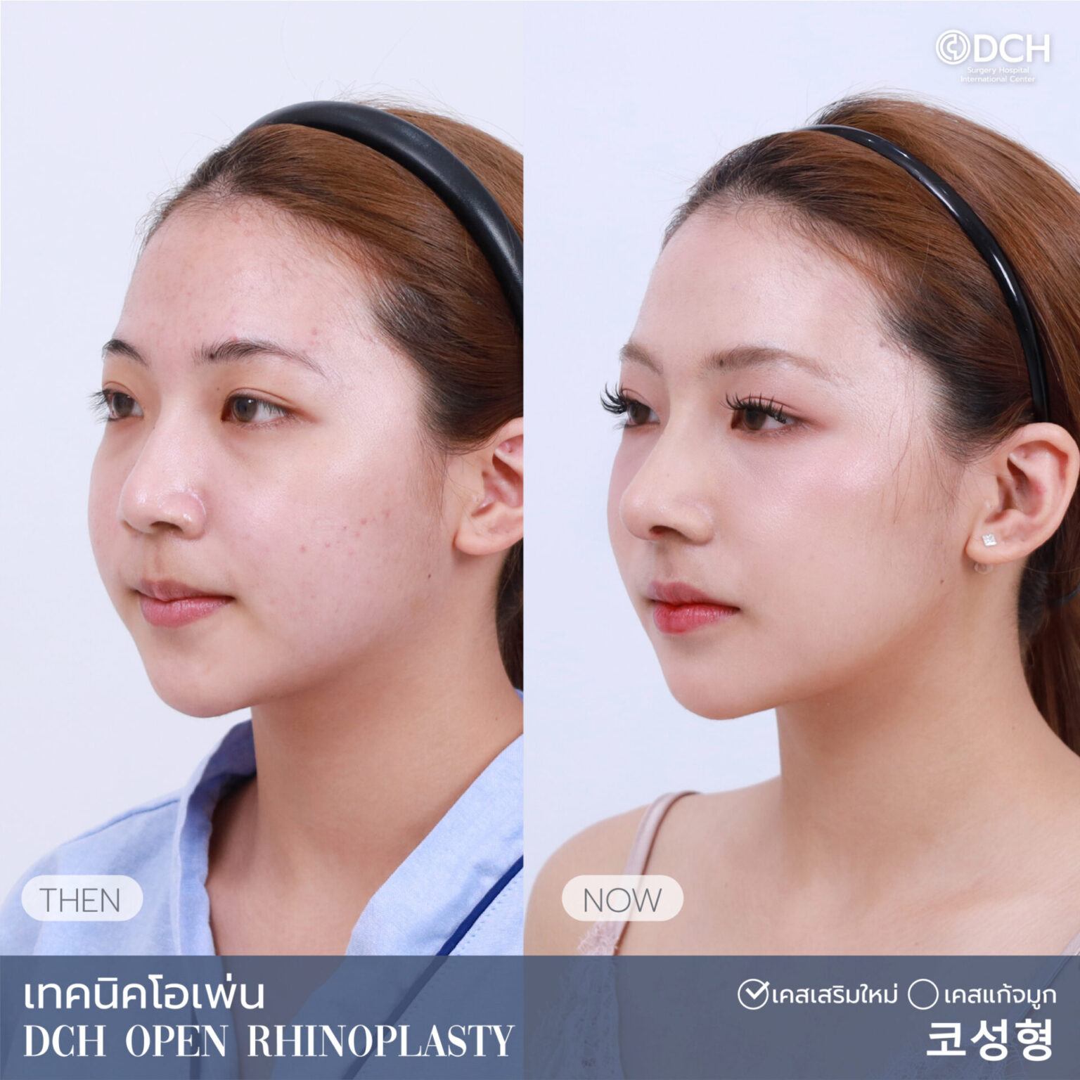 จุยเจีย1 (2)