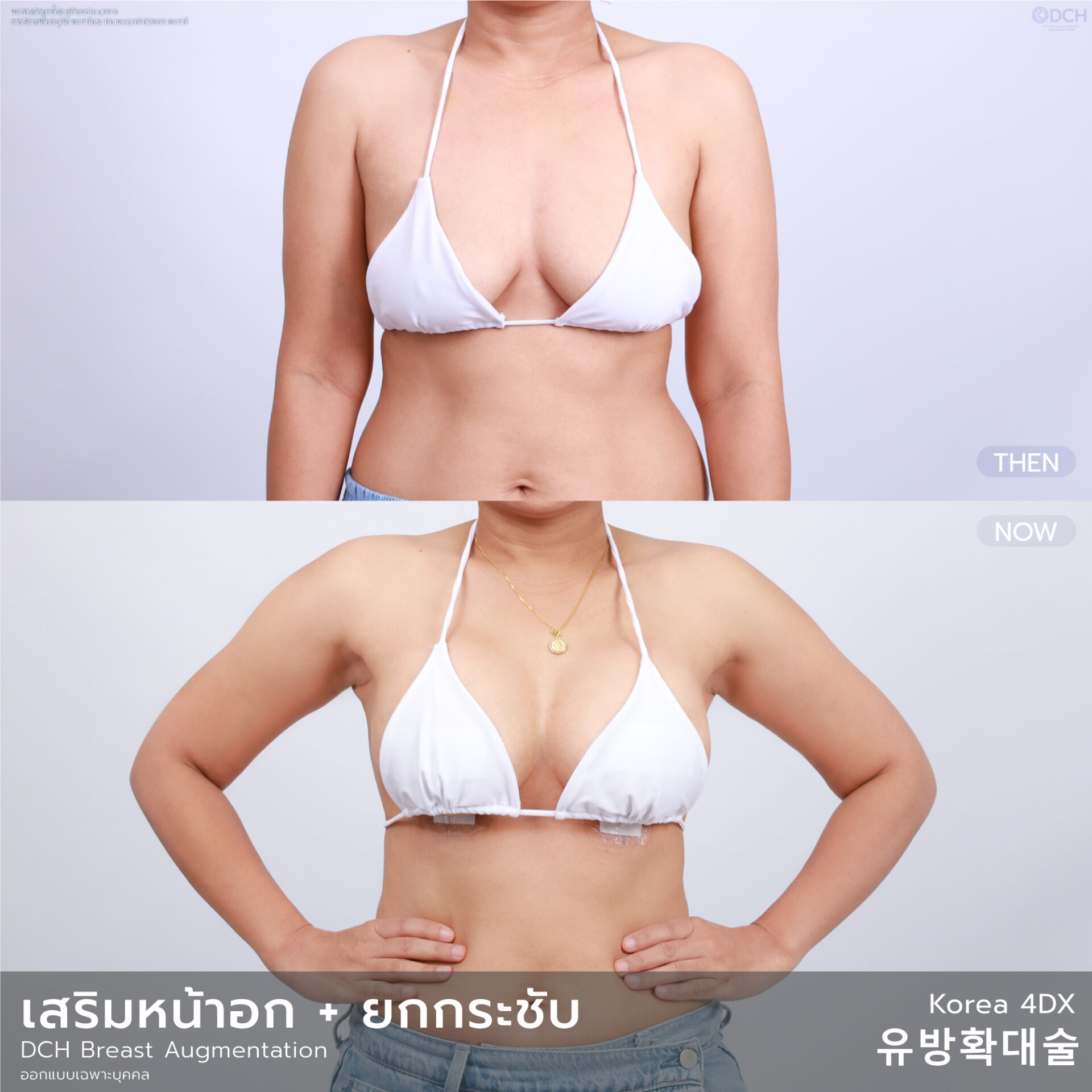 หน้าอก-ยกกระชับ-อัลบั้ม-06-1_0