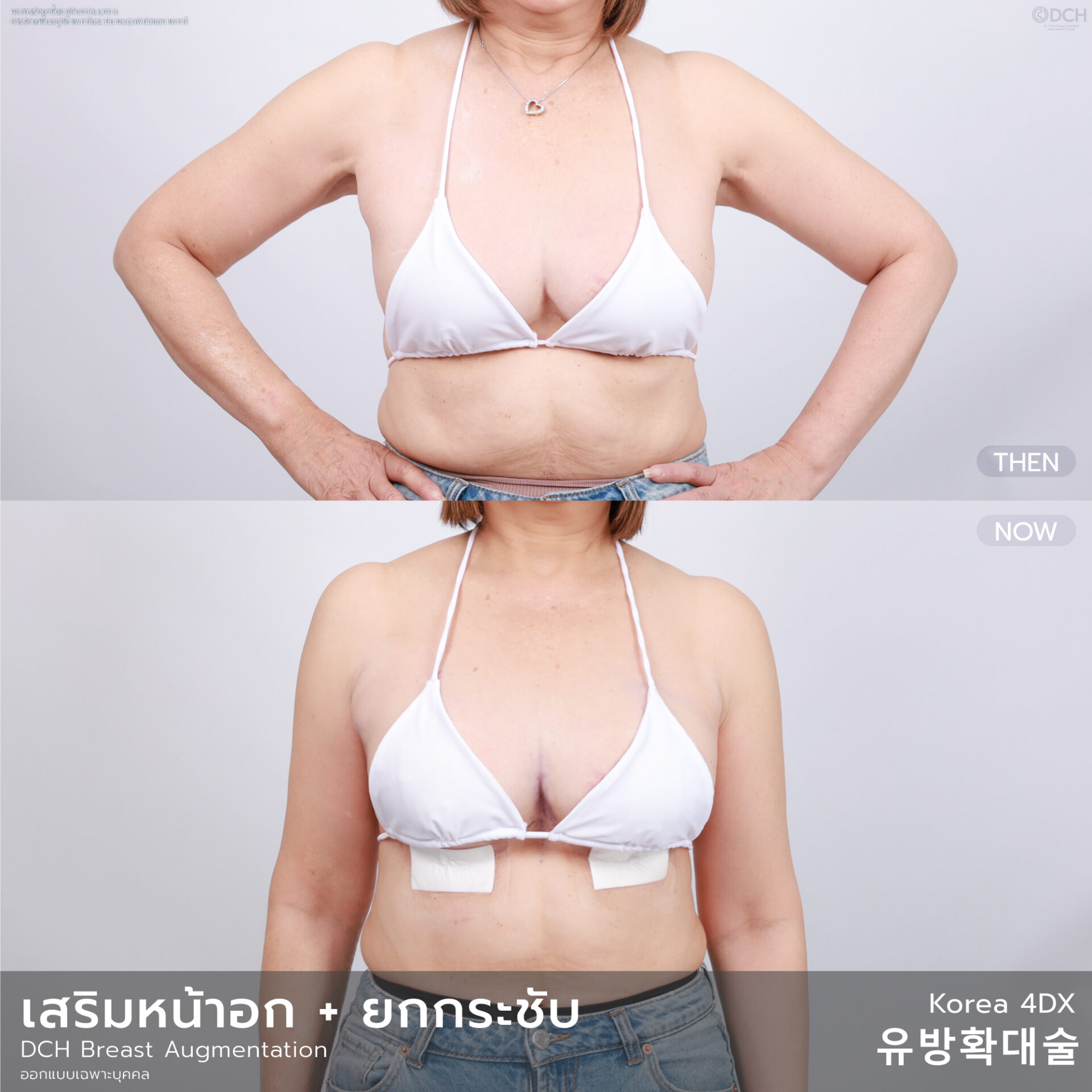 หน้าอก-ยกกระชับ-อัลบั้ม-07-1_0