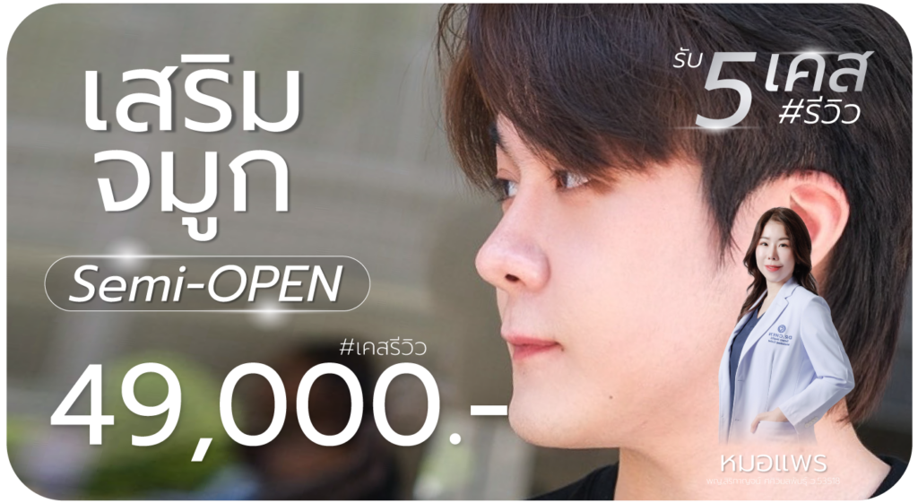 เสริมจมูก Semi Open