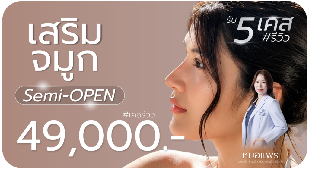เสริมจมูก Semi Open