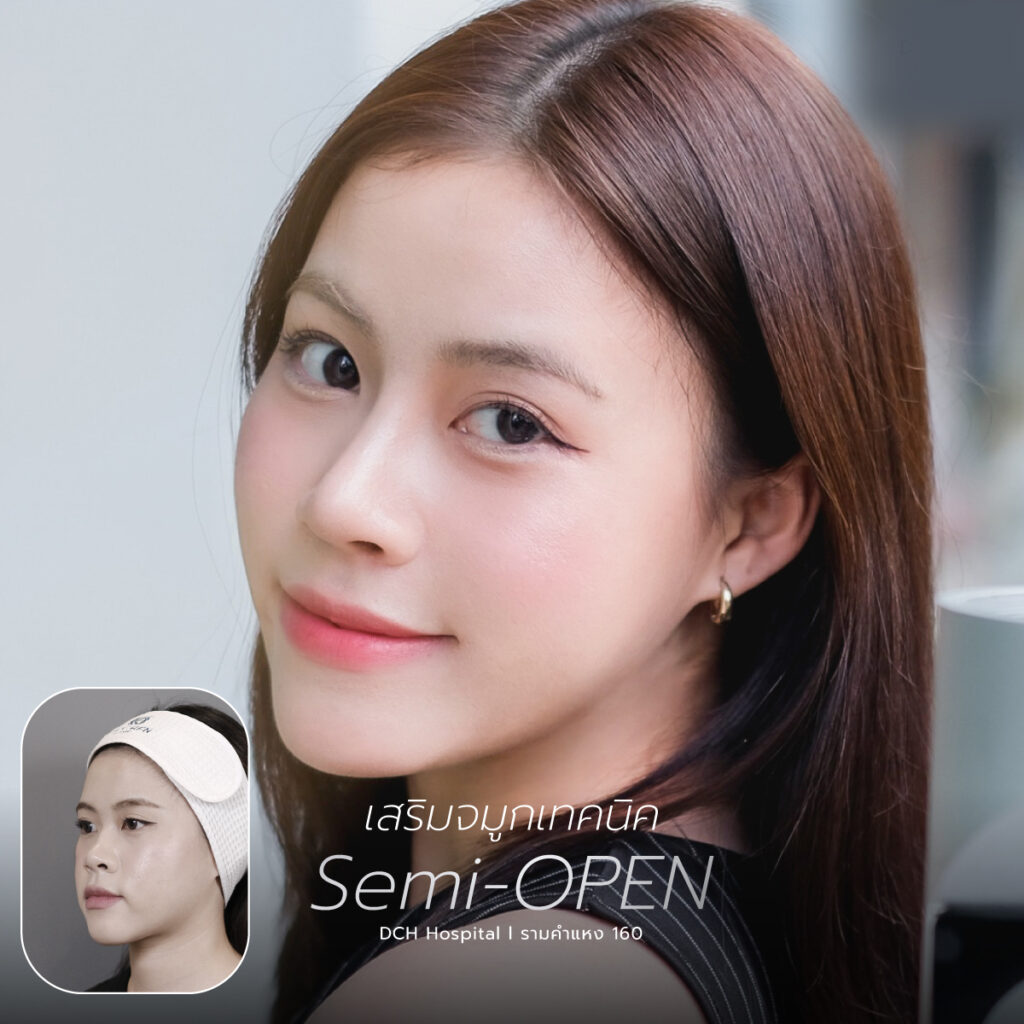 จมูก semi open
