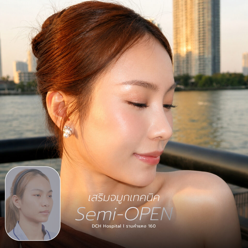 จมูก semi open