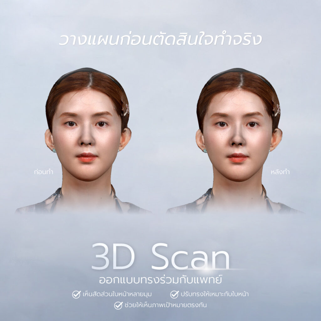 จมูก semi open
