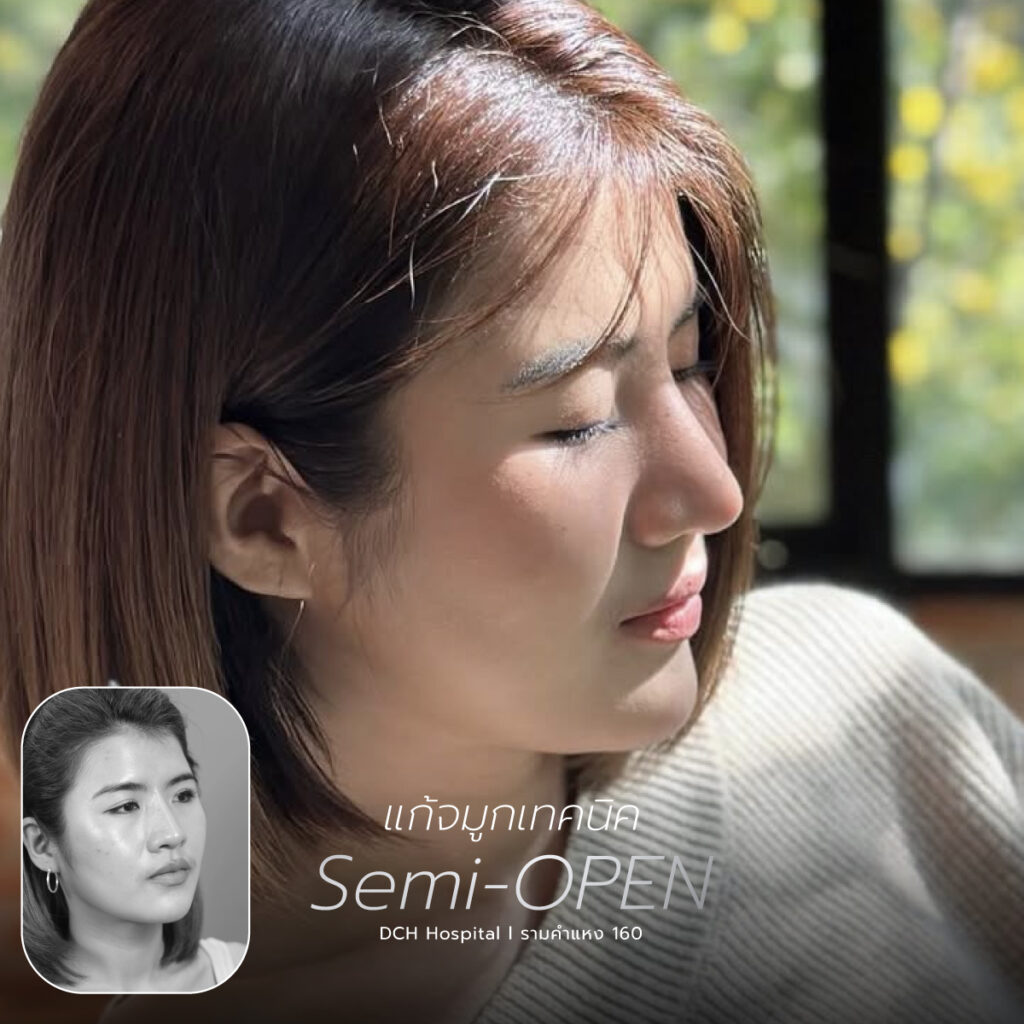 จมูก semi open