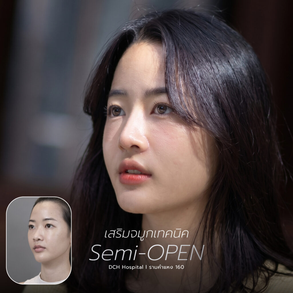 จมูก semi open
