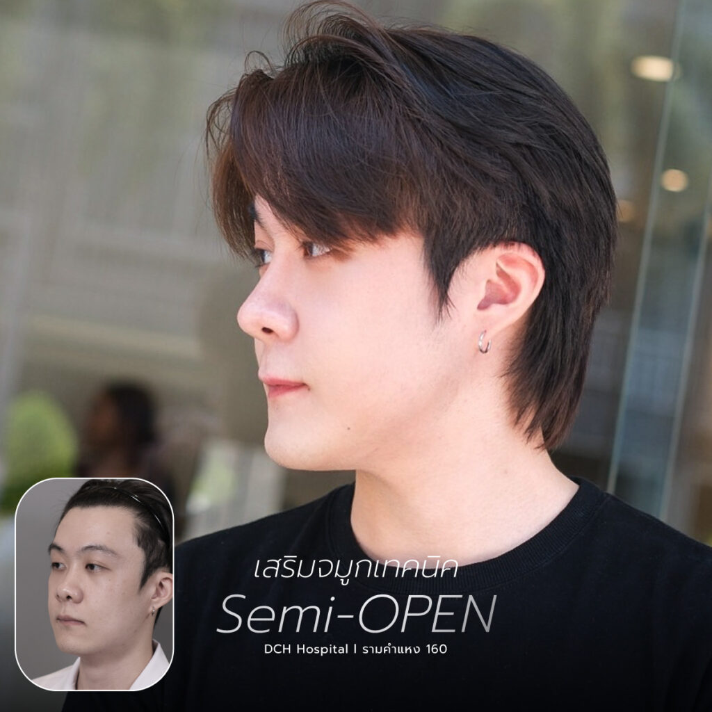 จมูก semi open